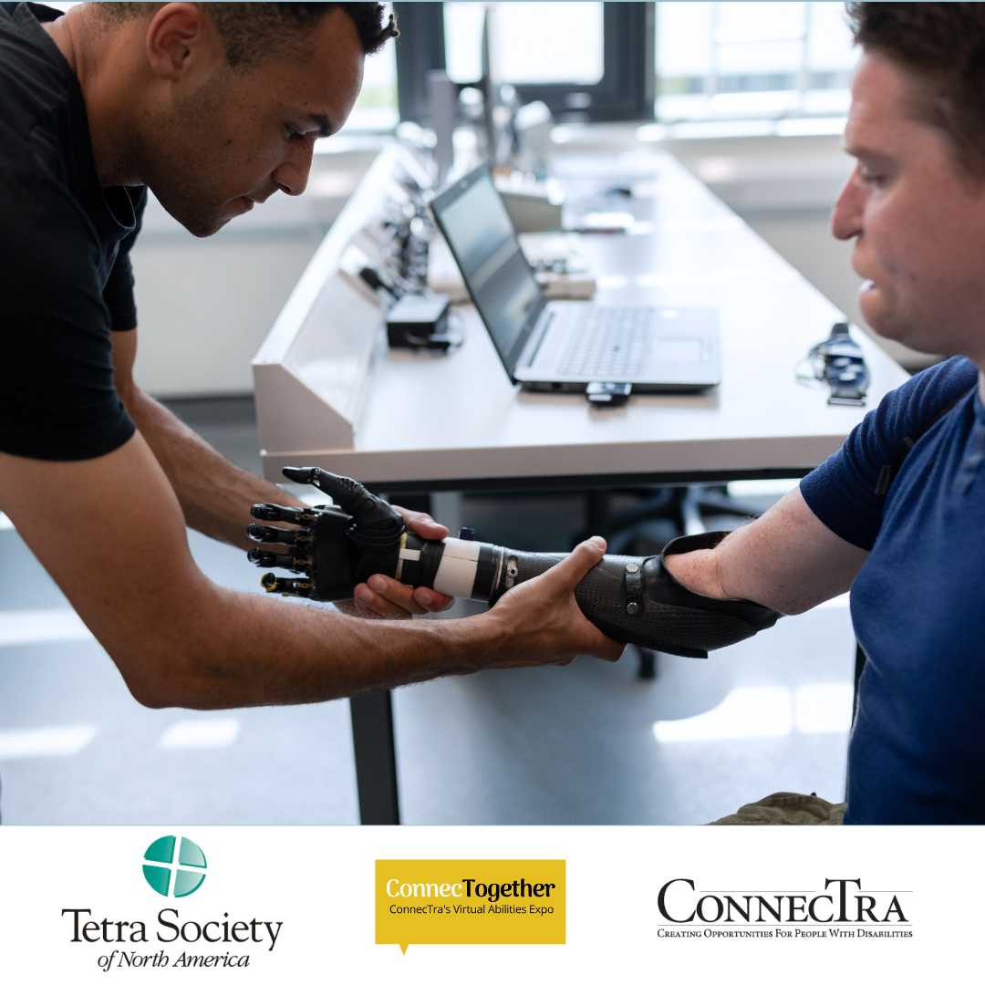 A man is helping a person fit on an arm prosthetic.